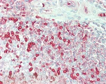 Carbonic Anhydrase I Antibody