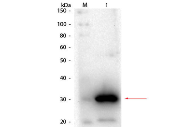 Carbonic Anhydrase I Antibody