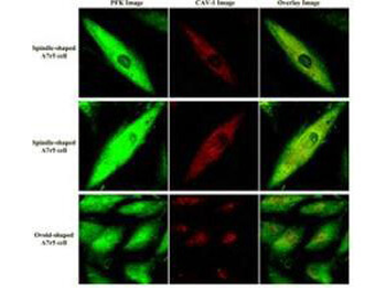 Fructose-6-Phosphate Kinase Antibody