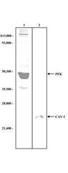 Fructose-6-Phosphate Kinase Antibody