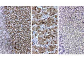 Pepsin Antibody