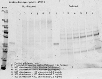 Aldolase Antibody Peroxidase Conjugated