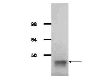 Aldolase Antibody Peroxidase Conjugated