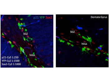 CDKN1A Antibody