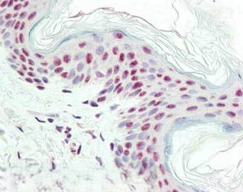 Hmgn1 Antibody