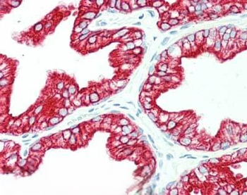 KRT6C Antibody