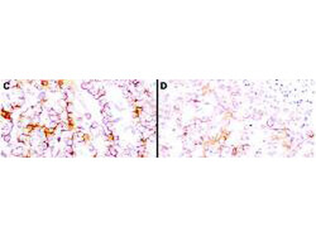 Mesothelin Antibody