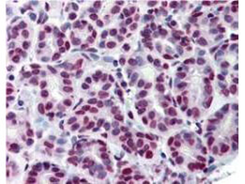 Stat5 phospho Y694 Antibody