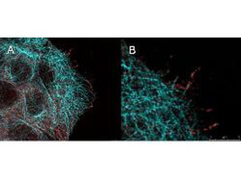 AKT phospho S473 Antibody