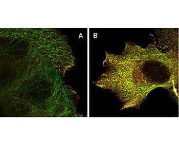 AKT phospho S473 Antibody