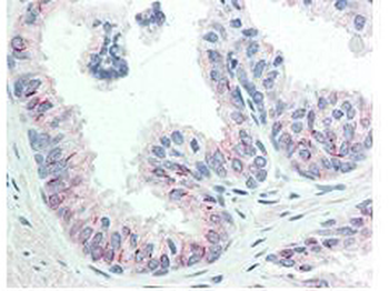AKT phospho S473 Antibody