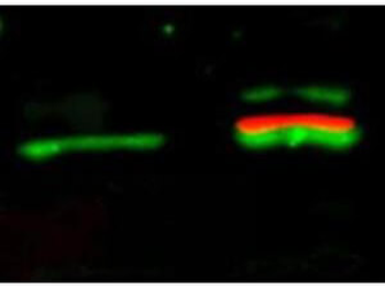 AKT phospho S473 Antibody