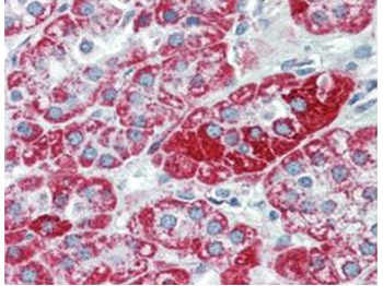 TRPC6 Antibody