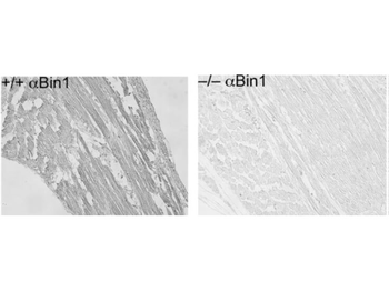 BIN1 Antibody
