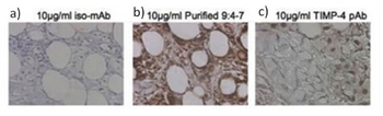 TIMP4 Antibody
