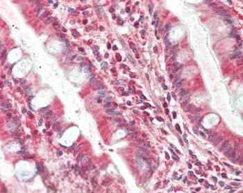 TIMP4 Antibody