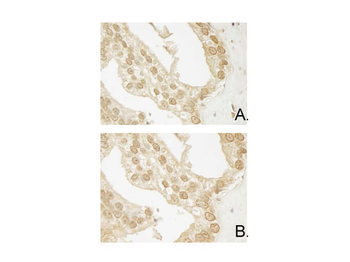 AKT3 Antibody