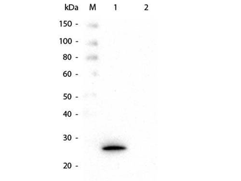 GSTK1 Antibody