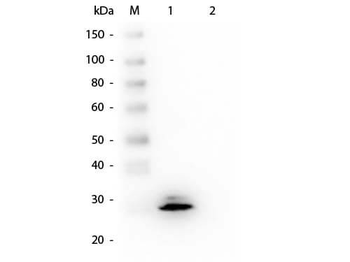 GSTO1 Antibody