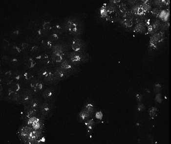 AKT3 Antibody