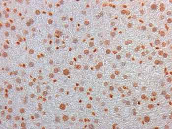 AKT3 FITC Antibody