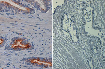 AKT phospho S473 Antibody Biotin Conjugated