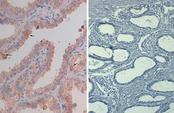 AKT phospho S473 Antibody Biotin Conjugated