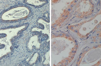 AKT phospho T308 Antibody Biotin Conjugated
