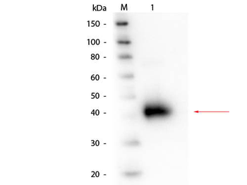 Alpha-1-Acid Glycoprotein Antibody