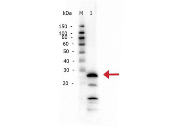 TRBOTR Antibody