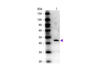 Adenosine Deaminase Antibody