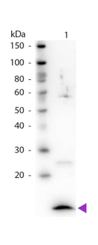 Beta-2-Microglobulin Antibody