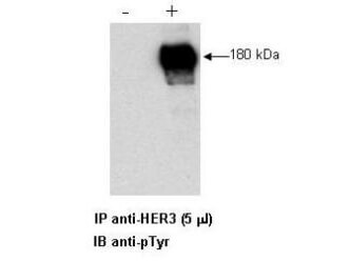 ERBB3 Antibody