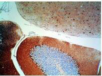 S100 Protein Antibody