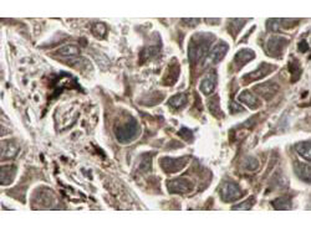 RFFL Antibody