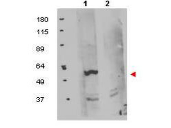FKBP8 Antibody