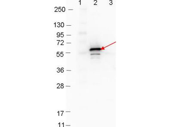 DbpB Antibody