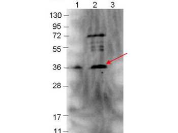 bmpA, BB_0383 Antibody