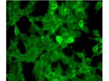 Beta-2-Microglobulin Antibody Peroxidase Conjugated