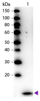 Beta-2-Microglobulin Antibody Peroxidase Conjugated