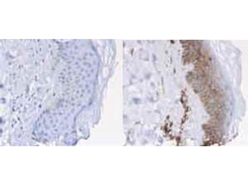 Beta-2-Microglobulin Antibody Peroxidase Conjugated