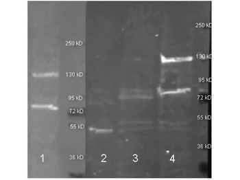ADA Antibody (Biotin)