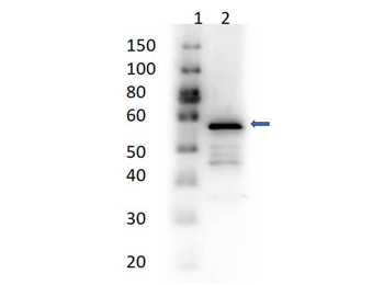Aldehyde Dehydrogenase Antibody