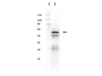 Hexokinase Antibody