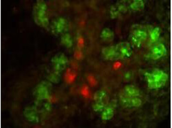 Elastase Antibody