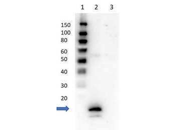 AVD Antibody