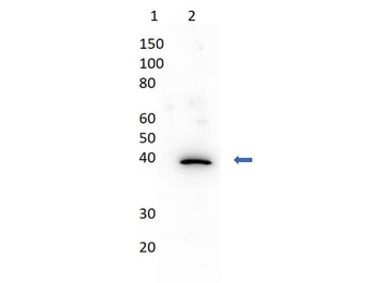 Mutarotase Antibody Biotin Conjugated