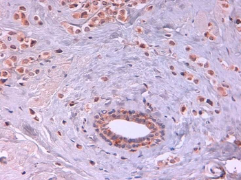 AKT2 Antibody