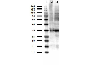 TYMS Antibody