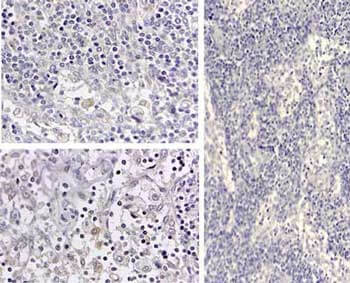 IL1B Antibody